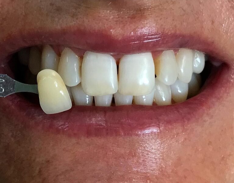 Screenshot_20240110_134715_Instagram