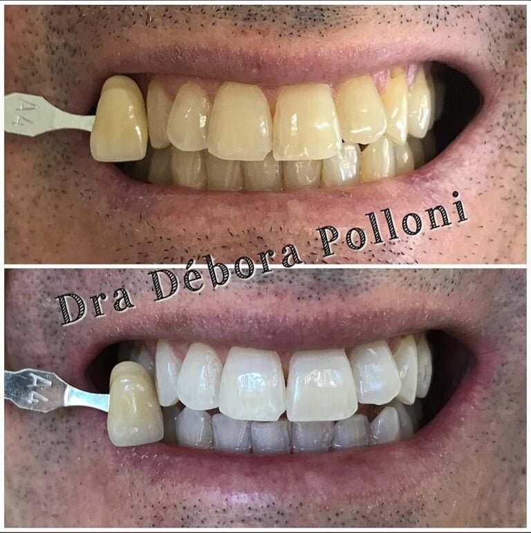 Screenshot_20240110_134737_Instagram