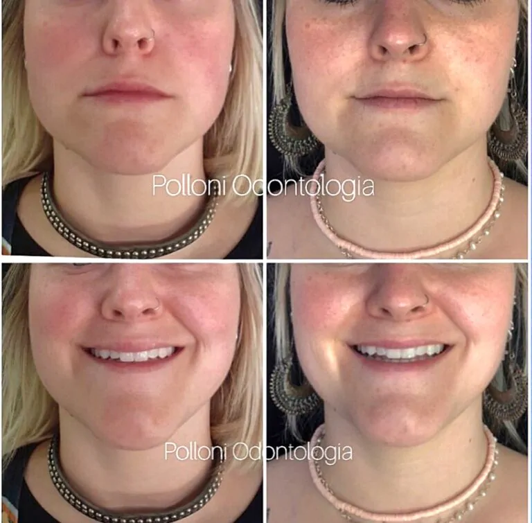 Screenshot_20240225_124705_Instagram