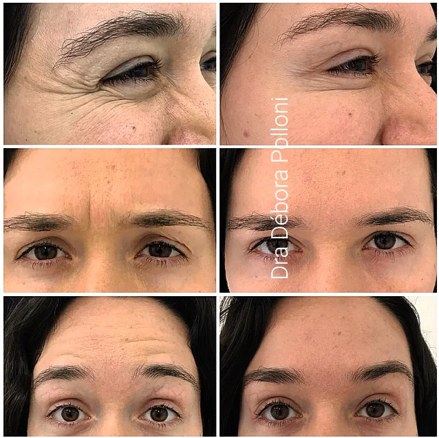 20170707_190204_FullSizeRender 2