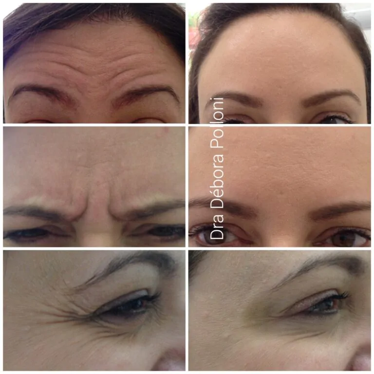 20171130_163352_IMG_6840