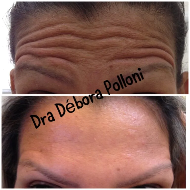 20171130_180948_IMG_6845