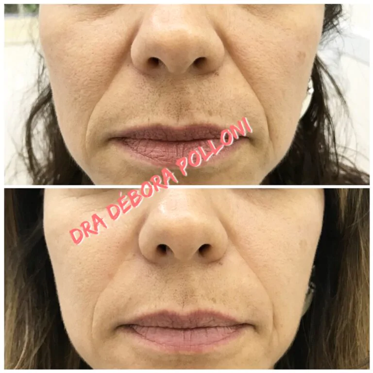 20180320_204355_IMG_0790