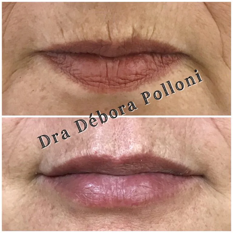 20180417_154512_IMG_1121