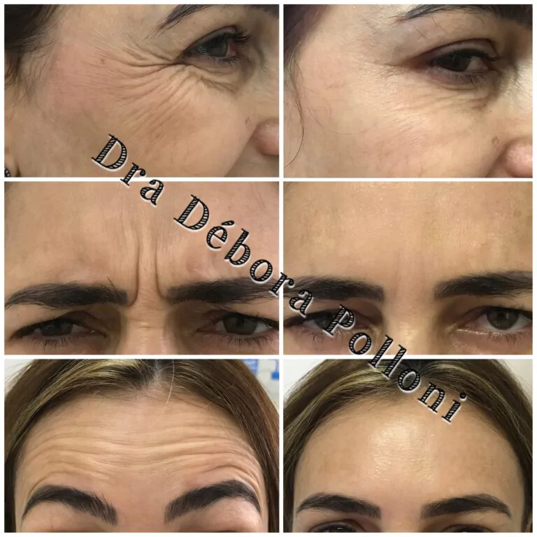 20180511_123857_IMG_1678