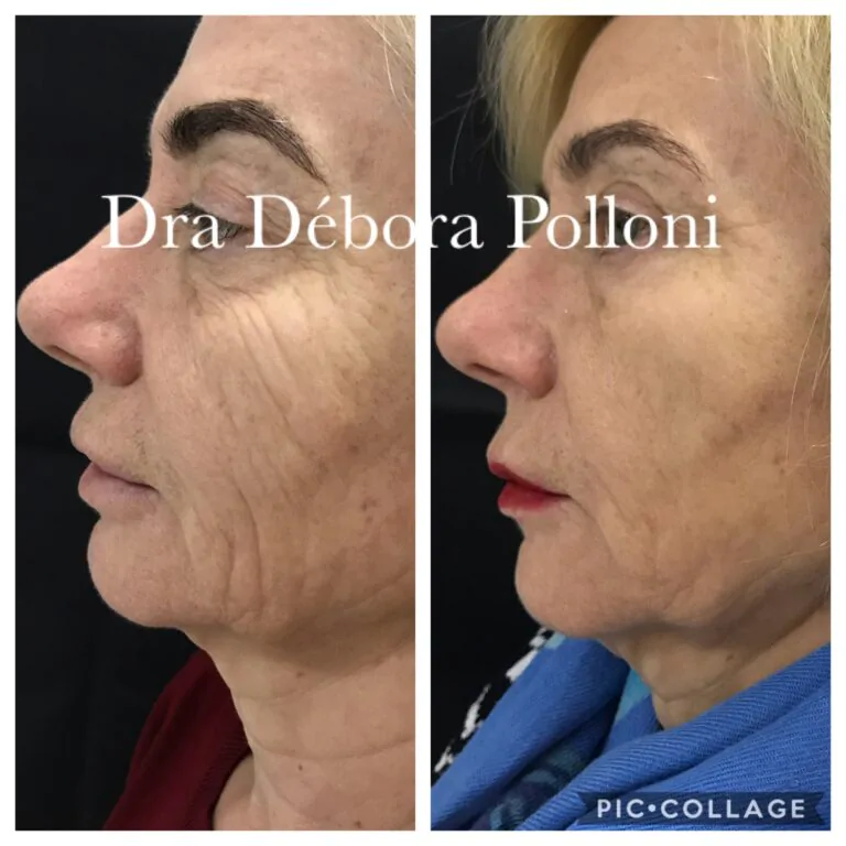 20190805_172626_IMG_0716