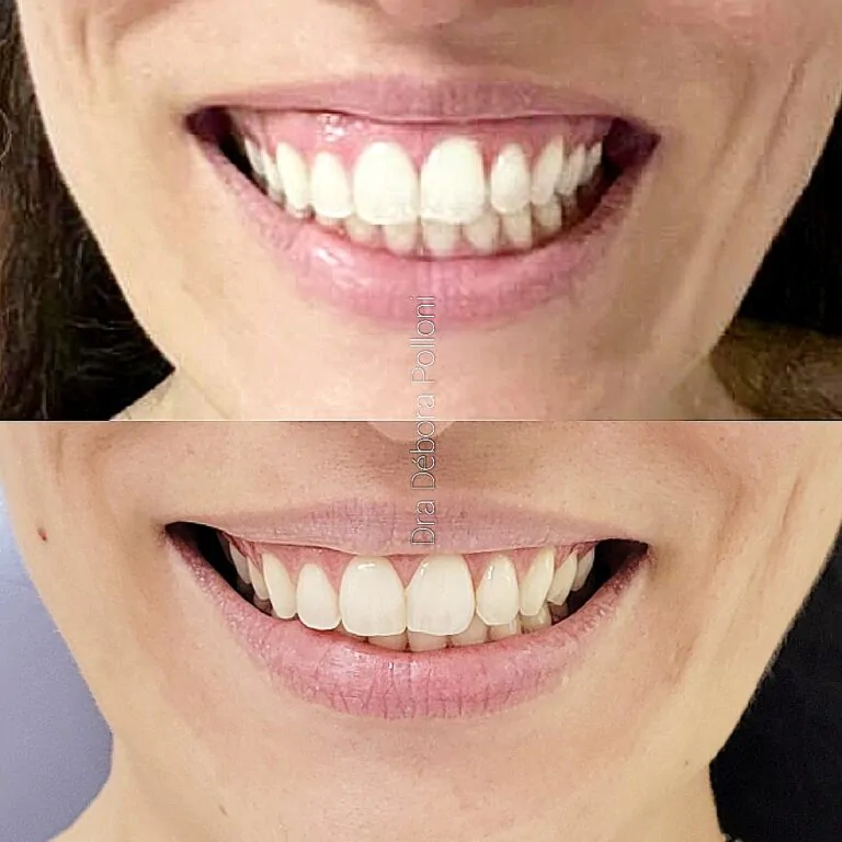 IMG_20220224_211727_414