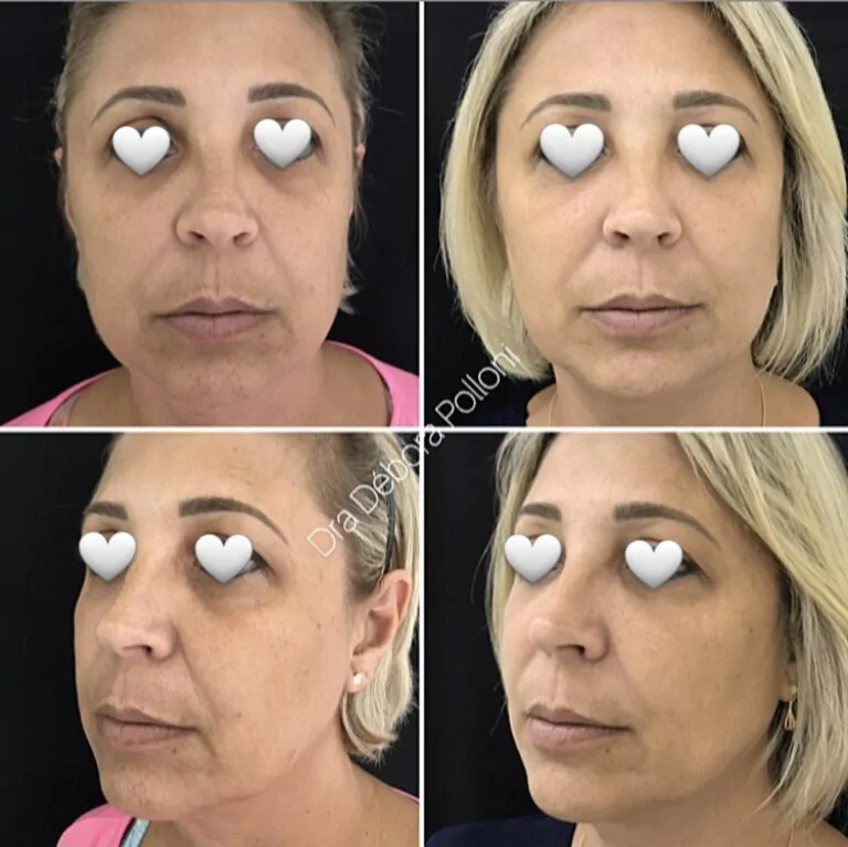 Screenshot_20240307_205732_Instagram