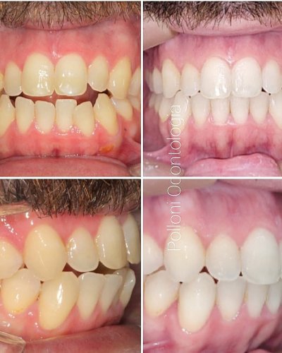 IMG_20220329_190034_133