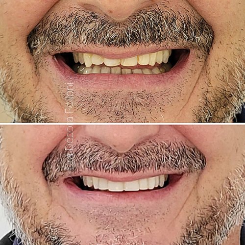 Screenshot_20220518-134622_Instagram