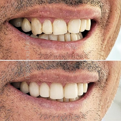 Screenshot_20230226-204108_Instagram