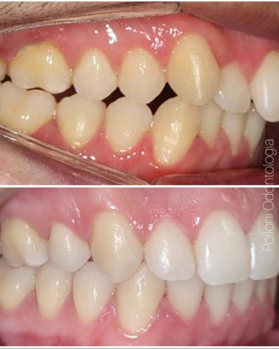 Screenshot_20230320-204829_InShot