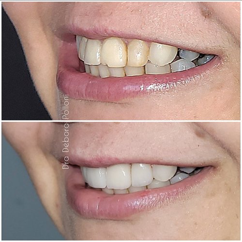 Screenshot_20230829_213227_InShot