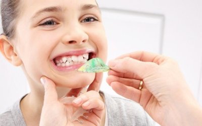 aparelho-de-crianca-aparelho-ortodontico-infantil