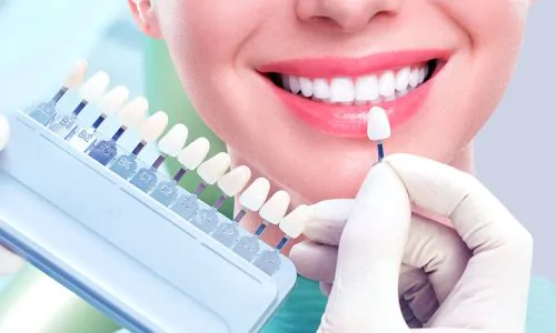 Close up portrait of Young women in dentist chair, Check and select the color of the teeth. Dentist makes the process of treatment in dental clinic office. Teeth whitenning.
