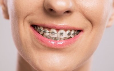 post_thumbnail-e3cc0c07dd988dc1bef1ba2ce1c6bcfa (2)