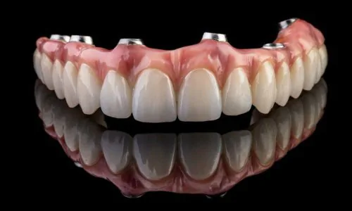 protese-protocolo-metaloceramica